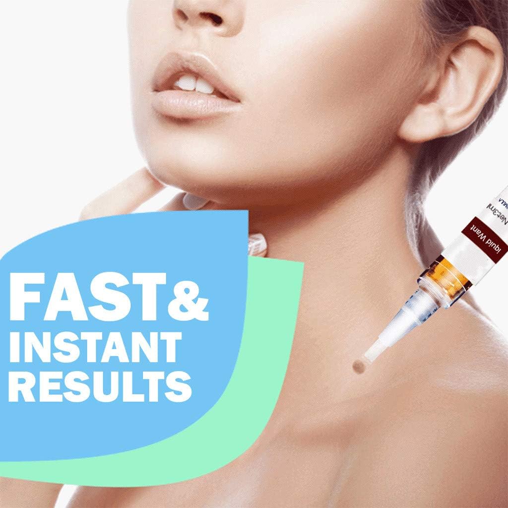 skin tag remover pen liquid wart remover